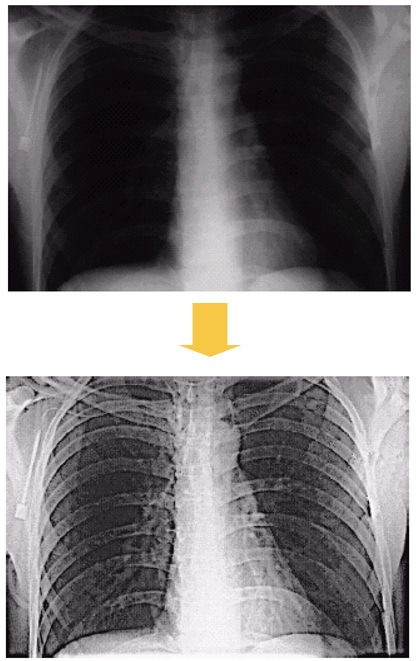 example-image-enhancement-1.png example-image-enhancement-1.png